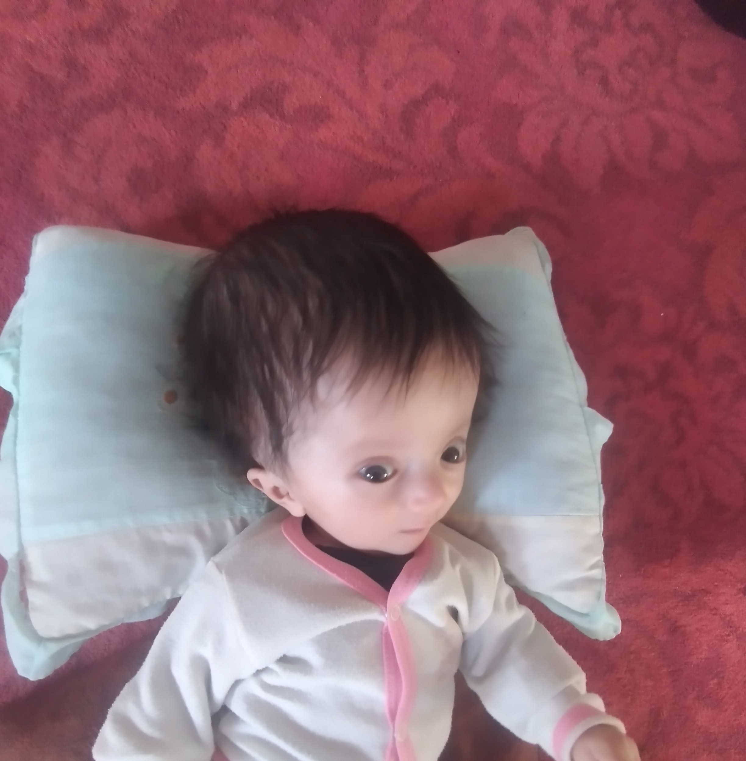 Help Provide Life-Saving Treatment for Baby Muaz (Hydrocephalus)