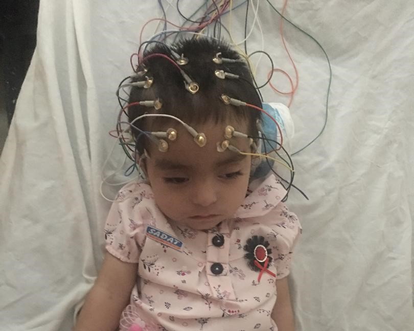 Kainat requires urgent surgery brain disorder