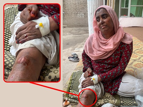 Help Nadia Fight Skin Cancer: A Mother’s Battle for Her Family