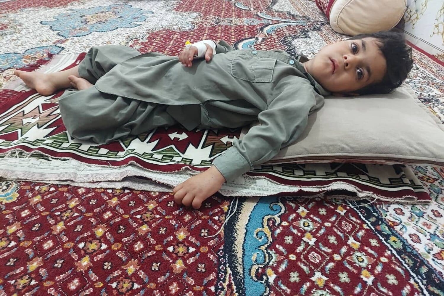 3-Year-Old Ehsanullah Needs Urgent Brain Surgery