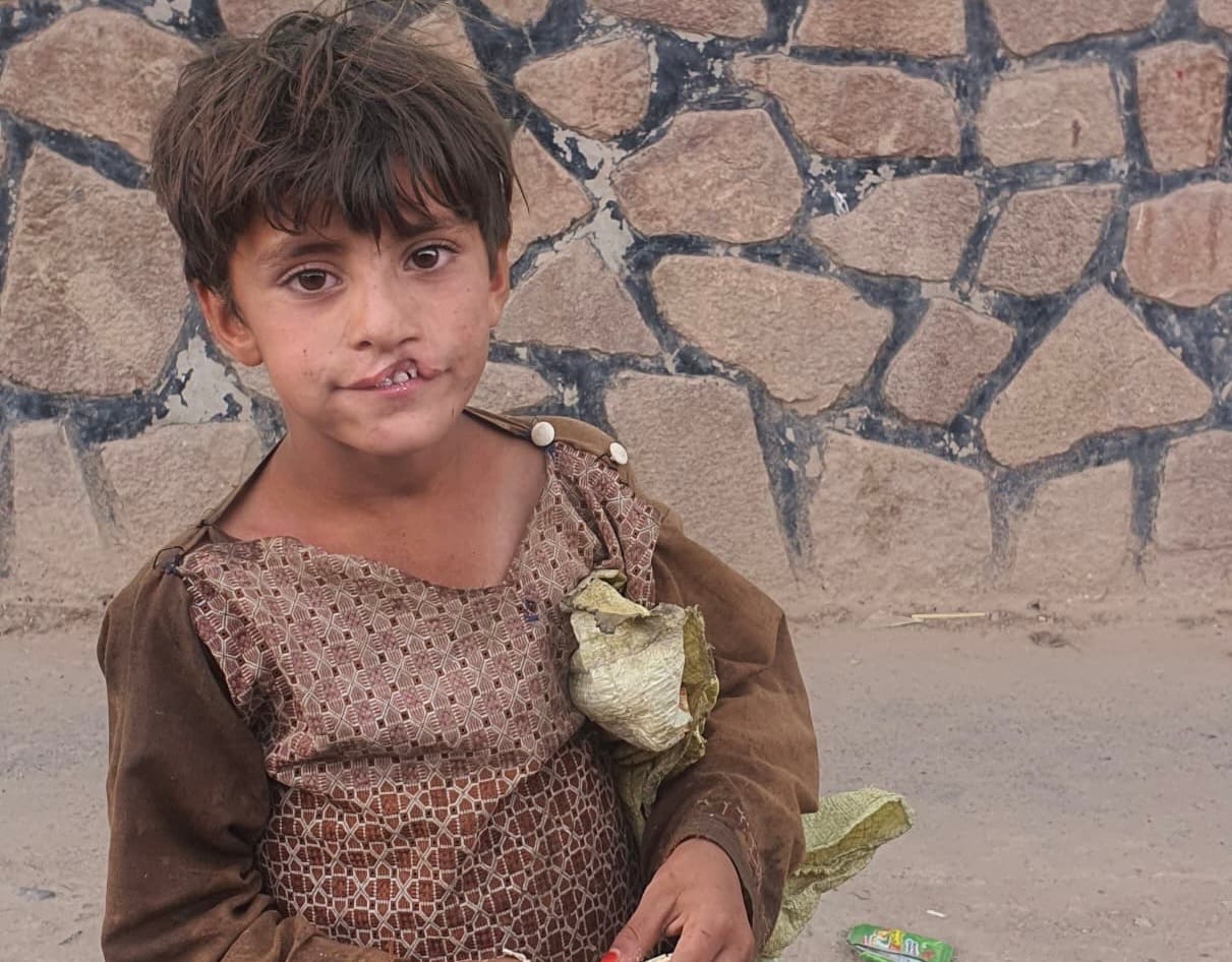 Help Little Haseeb Smile Again