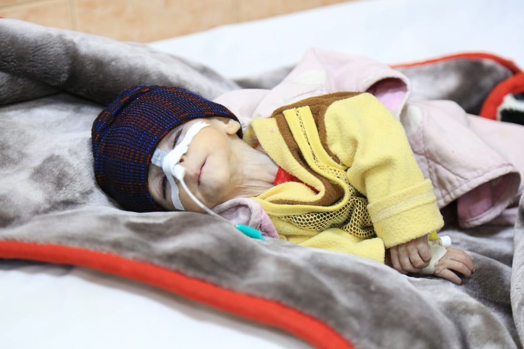 Save Afghanistan’s Disappearing Children from Malnutrition