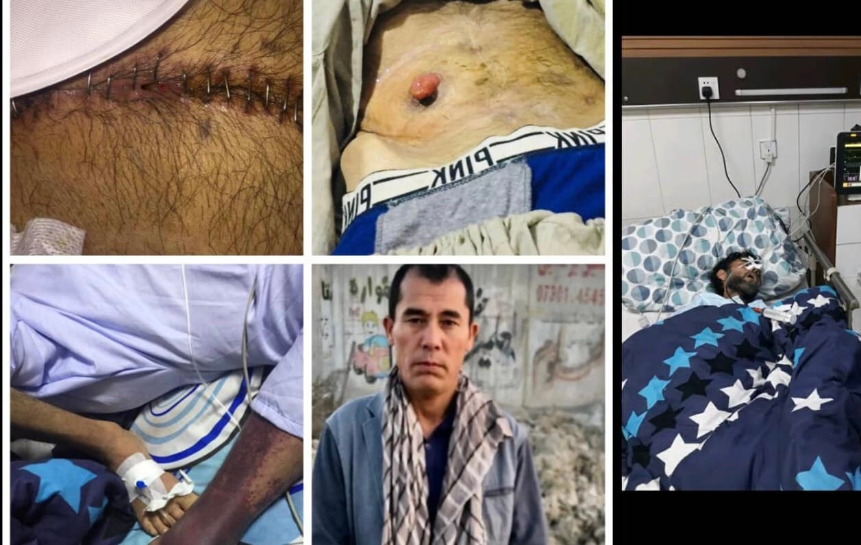 Urgent Help Needed For Abdul Rashid: Stomach Cancer and Homelessness