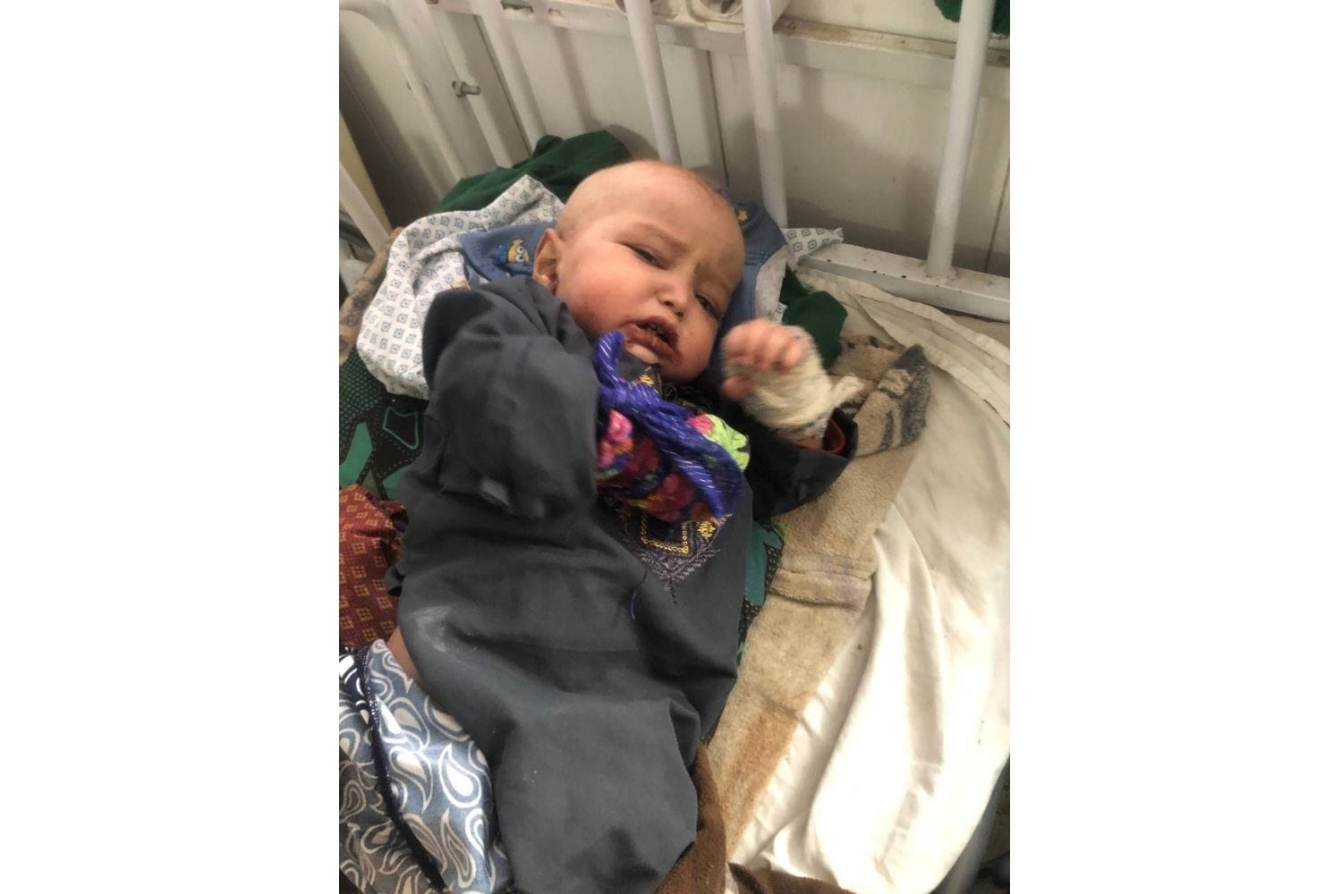 Omar, the orphaned child struggling with poverty and anemia 1