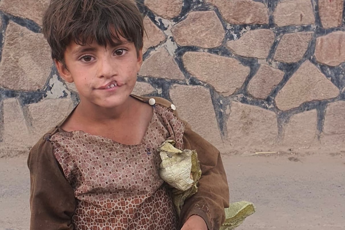 Help Little Haseeb Smile Again