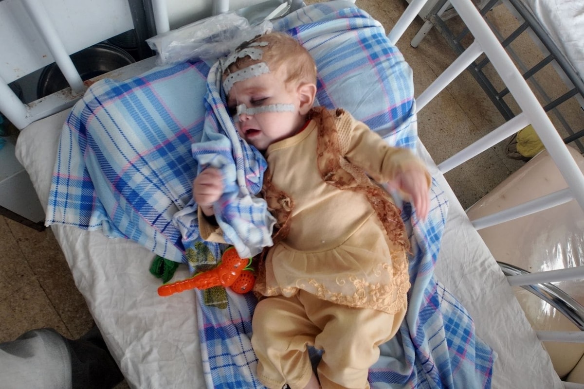 Save Children from Malnutrition 1