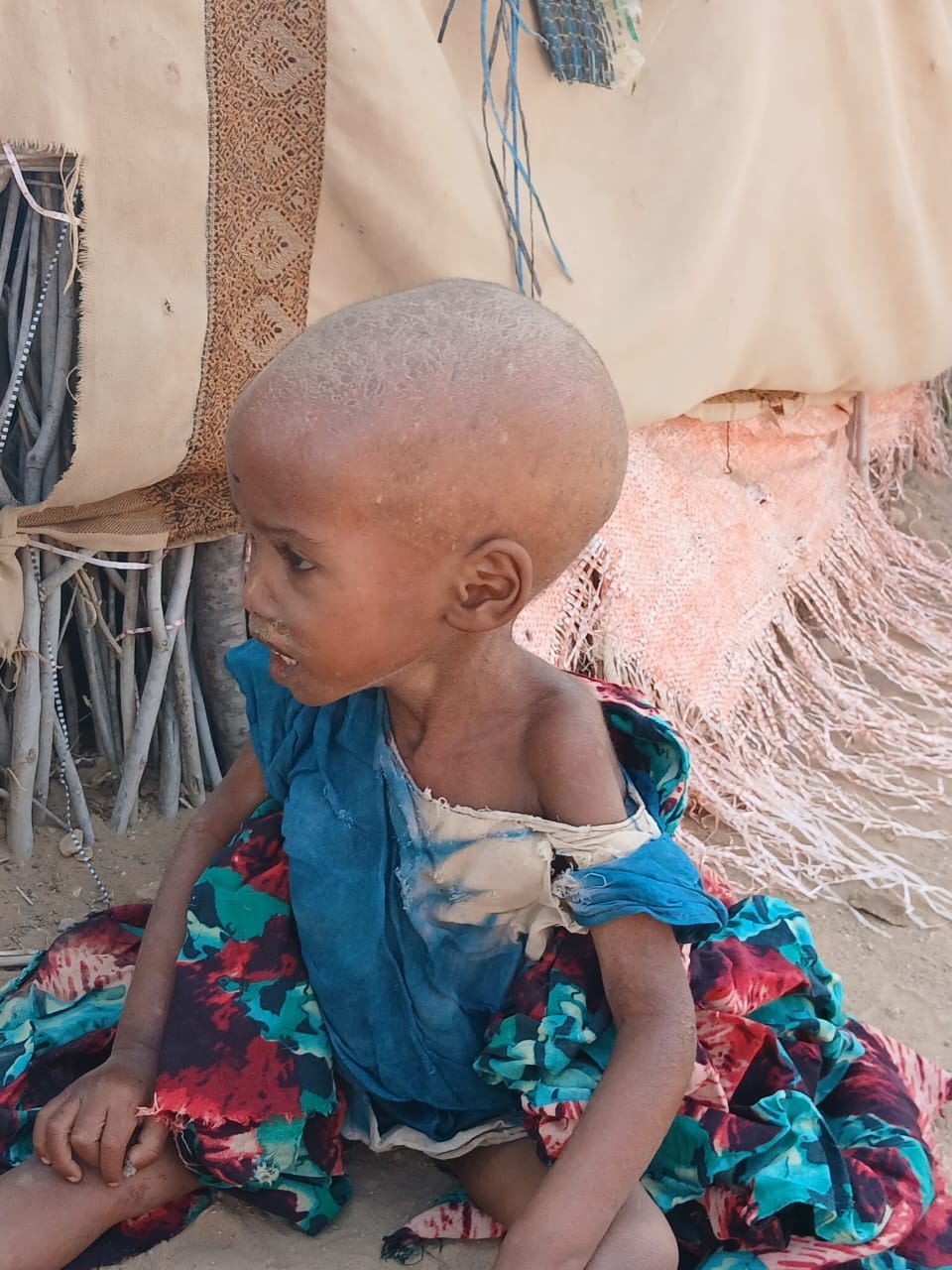 Feed the Hungry in Baardhere District 2