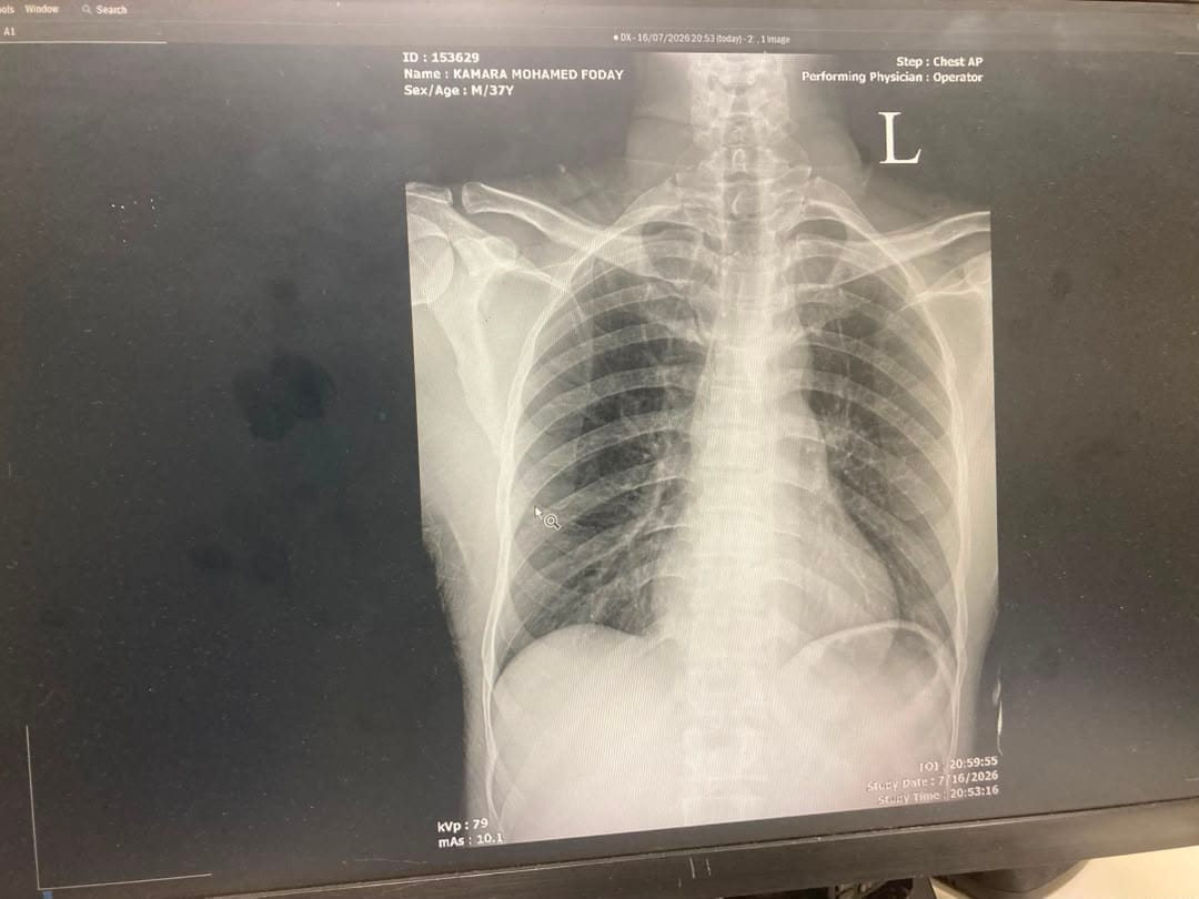 Help Mohamed Walk Again 3