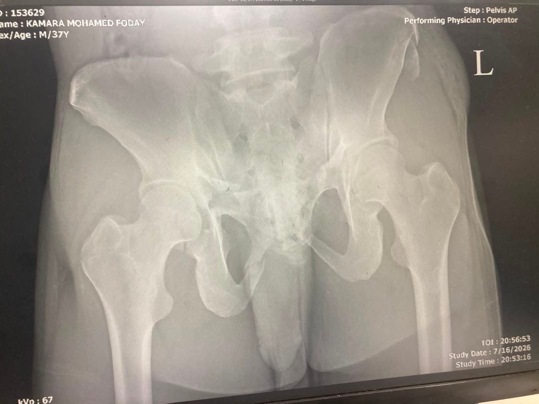Help Mohamed Walk Again 2