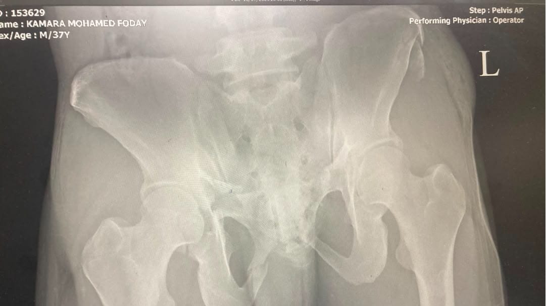 Help Mohamed Walk Again 1
