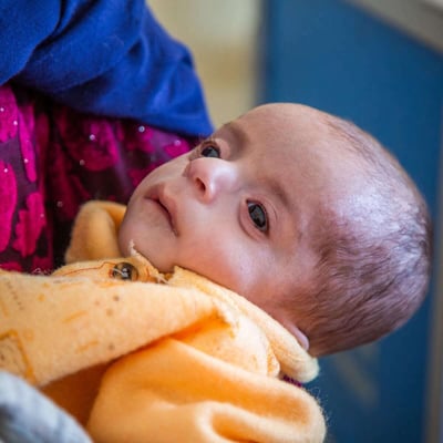 Child Relief | Support Emergency Nutrition Aid in Afghanistan
