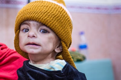 Tiny Fatima Is Just 6 Months Old—And Already Fighting to Survive